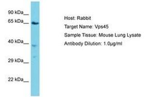 Image no. 1 for anti-Vacuolar Protein Sorting 45 (VPS45) (AA 468-517) antibody (ABIN6750334) (VPS45 antibody  (AA 468-517))