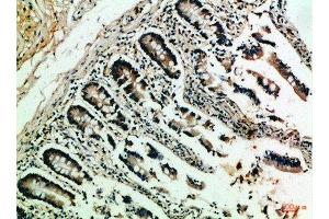 Immunohistochemical analysis of paraffin-embedded Human-colon, antibody was diluted at 1:100 (NFAT1 antibody  (AA 640-700))