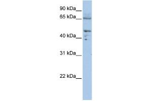 WB Suggested Anti-DLAT Antibody Titration:  0. (DLAT antibody  (C-Term))