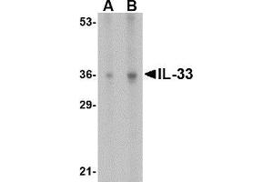 Western blot analysis of IL-33 in human lymph node tissue lysate with AP30426PU-N IL-33 antibody at (A) 1 and (B) 2 μg/ml. (IL-33 antibody  (N-Term))