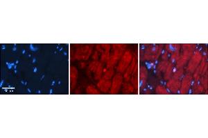 Rabbit Anti-Six1 Antibody    Formalin Fixed Paraffin Embedded Tissue: Human Adult heart  Observed Staining: Cytoplasmic,Nuclear (very rare in Nuclear) Primary Antibody Concentration: 1:600 Secondary Antibody: Donkey anti-Rabbit-Cy2/3 Secondary Antibody Concentration: 1:200 Magnification: 20X Exposure Time: 0. (SIX Homeobox 1 antibody  (N-Term))