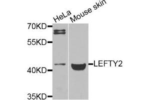 Western blot analysis of extracts of various cells, using LEFTY2 antibody. (LEFTY2 antibody)