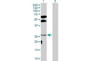Western Blot analysis of DLX3 expression in transfected 293T cell line by DLX3 MaxPab polyclonal antibody. (DLX3 antibody  (AA 1-287))