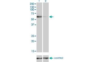 Western blot analysis of TRAF6 over-expressed 293 cell line, cotransfected with TRAF6 Validated Chimera RNAi (Lane 2) or non-transfected control (Lane 1).