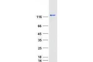 Validation with Western Blot (USP25 Protein (Myc-DYKDDDDK Tag))