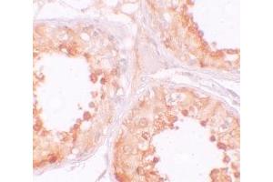Immunohistochemistry (IHC) image for anti-Y Box Binding Protein 2 (YBX2) (C-Term) antibody (ABIN1030807) (YBX2 antibody  (C-Term))