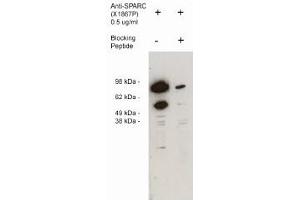 Image no. 1 for anti-Secreted Protein, Acidic, Cysteine-Rich (Osteonectin) (SPARC) antibody (ABIN265179) (SPARC antibody)
