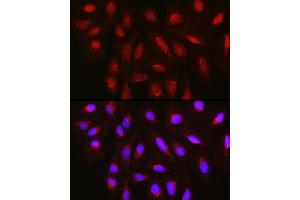 Immunofluorescence analysis of U2OS cells using TET3 Rabbit pAb (ABIN6133174, ABIN6149021, ABIN6149023 and ABIN6223527) at dilution of 1:150 (40x lens).