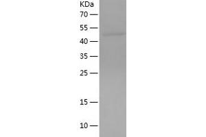 Western Blotting (WB) image for Interleukin 1 Receptor-Like 2 (IL1RL2) (AA 20-285) protein (His-IF2DI Tag) (ABIN7123527) (IL1RL2 Protein (AA 20-285) (His-IF2DI Tag))
