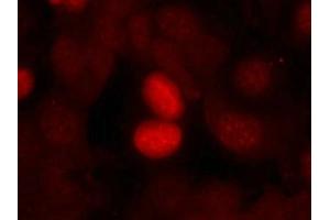 Immunofluorescence staining of methanol-fixed MCF7 cells using FKHR(Phospho-Ser256) Antibody. (FOXO1 antibody  (pSer256))
