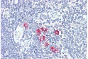 Anti-GlcNAc6ST2 / CHST4 antibody IHC staining of human thymus. (CHST4 antibody  (AA 234-283))