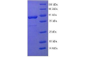SDS-PAGE (SDS) image for Fibroblast Growth Factor Receptor 3 (FGFR3) (AA 23-375), (Extracellular) protein (His tag) (ABIN5713454) (FGFR3 Protein (AA 23-375, Extracellular) (His tag))