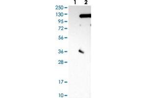 Western Blot (Cell lysate) analysis with SRPK2 polyclonal antibody  Lane 1: Negative control (vector only transfected HEK293T lysate)  Lane 2: Over-expression lysate (Co-expressed with a C-terminal myc-DDK tag (~3.