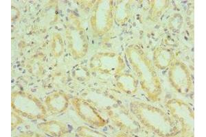 Immunohistochemistry of paraffin-embedded human kidney tissue using ABIN7155971 at dilution of 1:100 (HYAL2 antibody  (AA 367-473))