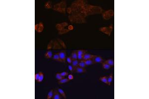 Immunofluorescence analysis of HeLa cells using CES1 Rabbit mAb (ABIN7266077) at dilution of 1:100 (40x lens). (CES1 antibody)