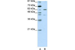 WB Suggested Anti-ZNF496 Antibody Titration:  1. (ZNF496 antibody  (N-Term))