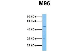 Host:  Rabbit  Target Name:  M96  Sample Tissue:  Human HCT116  Antibody Dilution:  1.