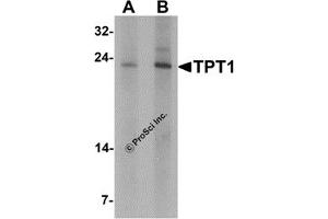 Western Blotting (WB) image for anti-Tumor Protein, Translationally-Controlled 1 (TPT1) antibody (ABIN1077430) (TPT1 antibody)