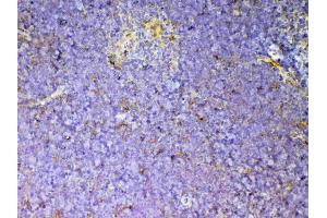 IHC analysis of CD59 using anti-CD59 antibody . (CD59a antibody  (AA 24-96))
