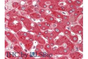 IHC-P analysis of Human Liver Tissue, with HE staining. (Ceruloplasmin antibody  (AA 789-1065))