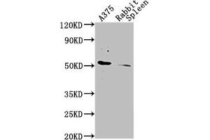 Western Blotting (WB) image for anti-CD63 (CD63) (AA 103-203) antibody (ABIN7147175)