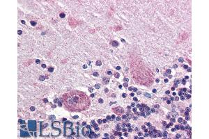 ABIN238630 (5µg/ml) staining of paraffin embedded Human Cerebellum. (PPP2R3A antibody  (Internal Region))