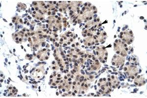 Human Pancreas (ZNF318 antibody  (N-Term))
