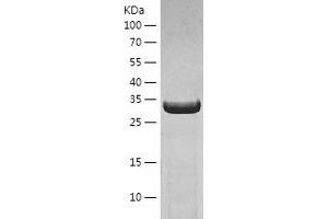 Western Blotting (WB) image for Pyrophosphatase 2 (PPA2) (AA 33-334) protein (His tag) (ABIN7124716) (PPA2 Protein (AA 33-334) (His tag))