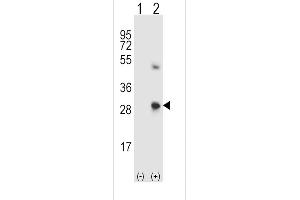 Western blot analysis of SPARC using rabbit polyclonal SPARC Antibody using 293 cell lysates (2 ug/lane) either nontransfected (Lane 1) or transiently transfected (Lane 2) with the SPARC gene. (SPARC antibody  (C-Term))