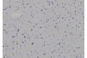 ABIN6269296 at 1/100 staining Human heart tissue by IHC-P. (14-3-3 zeta antibody  (C-Term))