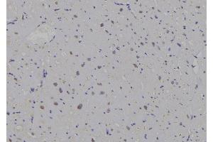 ABIN6269296 at 1/100 staining Human heart tissue by IHC-P. (14-3-3 zeta antibody  (C-Term))