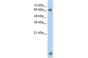 WB Suggested Anti-MBD1 Antibody Titration:  0. (MBD1 antibody  (C-Term))
