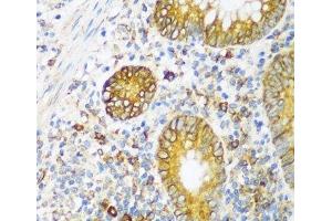 Immunohistochemistry of paraffin-embedded Human appendix using ERLIN1 Polyclonal Antibody at dilution of 1:100 (40x lens). (ERLIN1 antibody)
