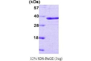 PTPN1 Protein