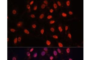 Immunofluorescence analysis of U-2 OS cells using Bcl-2 Polyclonal Antibody at dilution of 1:100 (40x lens). (Bcl-2 antibody)