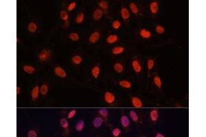 Immunofluorescence analysis of U-2 OS cells using Bcl-2 Polyclonal Antibody at dilution of 1:100 (40x lens). (Bcl-2 antibody)