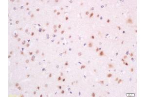 Formalin-fixed and paraffin embedded rat brain labeled with Anti-SFRS7/9G8 Polyclonal Antibody, Unconjugated  at 1:200 followed by conjugation to the secondary antibody and DAB staining (SFRS7 antibody  (AA 2-70))
