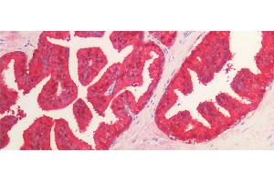 Detection of IDH1 in Human Prostate Tissue using Monoclonal Antibody to Isocitrate Dehydrogenase 1, Soluble (IDH1) (IDH1 antibody  (AA 74-333))