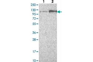 Western blot analysis of Lane 1: Negative control (vector only transfected HEK293T lysate) Lane 2: Over-expression lysate (Co-expressed with a C-terminal myc-DDK tag (~3. (FGFR4 antibody)