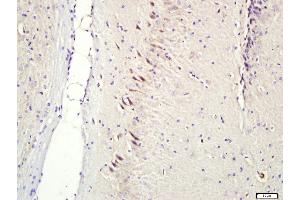 Paraformaldehyde-fixed, paraffin embedded Rat brain; Antigen retrieval by boiling in sodium citrate buffer (pH6. (CNIH2, CNIH3 (AA 25-120) antibody)