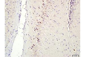 Paraformaldehyde-fixed, paraffin embedded Rat brain; Antigen retrieval by boiling in sodium citrate buffer (pH6. (CNIH2, CNIH3 (AA 25-120) antibody)