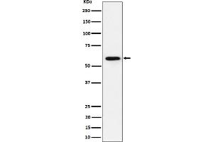 Western blot analysis of PRPF31 expression in Jurkat cell lysate.