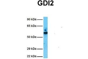 Host:  Rabbit  Target Name:  GDI2  Sample Tissue:  Human Fetal Lung  Antibody Dilution:  1. (GDI2 antibody  (C-Term))