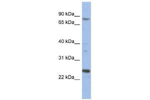 MARK3 antibody used at 1 ug/ml to detect target protein.
