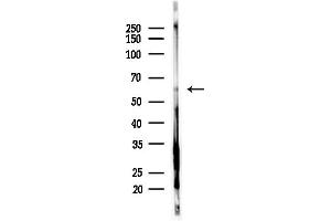 anti-serine/threonine Kinase 33 (STK33) (N-Term) antibody