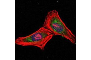 Immunofluorescence (IF) image for anti-Proteasome (Prosome, Macropain) Subunit, beta Type, 8 (Large Multifunctional Peptidase 7) (PSMB8) antibody (ABIN969371)