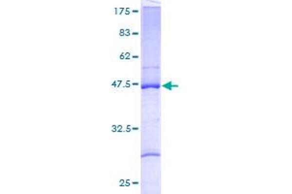 RPL27A Protein (AA 1-148) (GST tag)