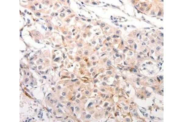 Keratin 6C antibody  (Internal Region)
