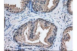 Immunohistochemistry (IHC) image for anti-Nucleoredoxin-Like 2 (NXNL2) antibody (ABIN1499887) (NXNL2 antibody)