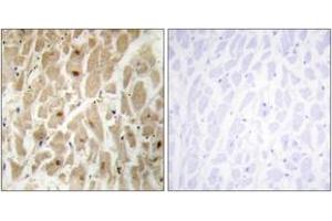 Immunohistochemistry analysis of paraffin-embedded human heart tissue, using FOXD3 Antibody. (FOXD3 antibody  (AA 211-260))